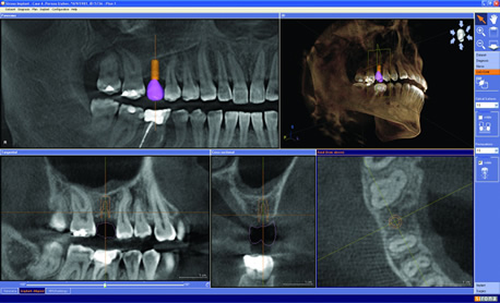 3D Imaging by Sirona