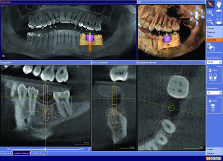 Sinora 3D imaging